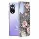 Techsuit Marble Series maska za Huawei Nova 9 / Honor 50 Bloom of Ruth Gray